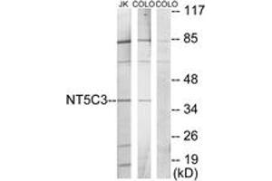 Image no. 1 for anti-5'-Nucleotidase, Cytosolic III (NT5C3) (AA 11-60) antibody (ABIN1534118)