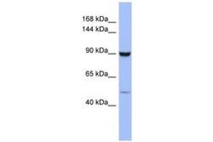 Image no. 1 for anti-Zinc Finger Protein 28 (ZFP28) (AA 791-840) antibody (ABIN6742858)