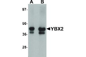 Image no. 1 for anti-Y Box Binding Protein 2 (YBX2) (C-Term) antibody (ABIN6656417)