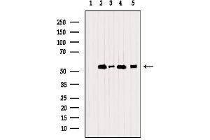 Image no. 3 for anti-Protein Disulfide Isomerase Family A, Member 6 (PDIA6) (C-Term) antibody (ABIN6264114)