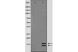 Image no. 1 for anti-Microtubule-Associated Protein 1 Light Chain 3 beta (MAP1LC3B) (N-Term) antibody (ABIN6262925)