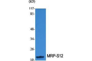 Image no. 1 for anti-Mitochondrial Ribosomal Protein S34 (MRPS34) (Internal Region) antibody (ABIN3185671)