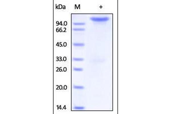 Neuropilin 1 (NRP1) (AA 22-644) (Active) protein (Fc Tag)