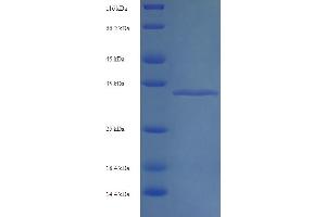 Image no. 1 for RNA Binding Motif Protein 3 (RBM3) (AA 1-157), (full length) protein (His-SUMO Tag) (ABIN5710219)