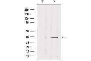 Image no. 2 for anti-SRY (Sex Determining Region Y)-Box 12 (SOX12) (Internal Region) antibody (ABIN6265232)