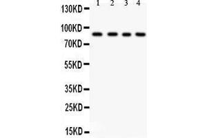 Image no. 2 for anti-Inhibitor of kappa Light Polypeptide Gene Enhancer in B-Cells, Kinase beta (IKBKB) (AA 398-756) antibody (ABIN3042734)