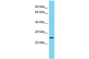 VCX3A antibody  (N-Term)