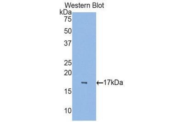 anti-Retinol Binding Protein 7, Cellular (RBP7) (AA 1-134) antibody