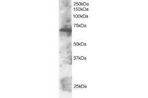 Image no. 3 for anti-SWAP Switching B-Cell Complex 70kDa Subunit (SWAP70) (C-Term) antibody (ABIN184723)