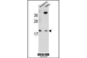 Image no. 3 for anti-Ring Finger Protein 185 (RNF185) (AA 88-117) antibody (ABIN654772)