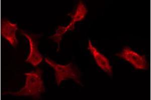 Image no. 5 for anti-V-Akt Murine Thymoma Viral Oncogene Homolog 1 (AKT1) (pSer124) antibody (ABIN6256119)