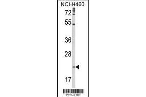 Image no. 1 for anti-Tetraspanin 31 (TSPAN31) (AA 102-128) antibody (ABIN652527)