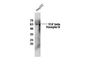 Image no. 3 for anti-Transforming Growth Factor, beta Receptor II (70/80kDa) (TGFBR2) (AA 241-330) antibody (ABIN725225)