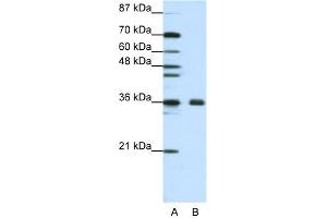 Image no. 1 for anti-Fibrillarin (FBL) (N-Term) antibody (ABIN2778775)