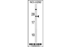 Image no. 1 for anti-Retinoic Acid Receptor Responder (Tazarotene Induced) 3 (RARRES3) (AA 43-71) antibody (ABIN1538411)
