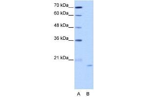 Image no. 3 for anti-Nucleolar Protein 6 (NOL6) (C-Term) antibody (ABIN2776562)