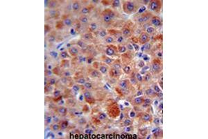 Image no. 2 for anti-Complement Factor H (CFH) (AA 751-780), (Middle Region) antibody (ABIN951646)