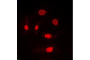 Image no. 1 for anti-Transformer 2 alpha Homolog (TRA2A) (C-Term) antibody (ABIN2705303)