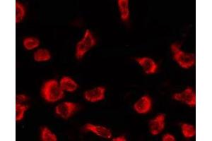 OR4C12 antibody  (Internal Region)