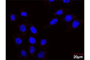 Image no. 6 for FLT1 & CRKL Protein Protein Interaction Antibody Pair (ABIN1340156)