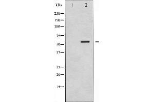 Image no. 4 for anti-Calcium/calmodulin-Dependent Protein Kinase IV (CAMK4) (pThr200) antibody (ABIN6256500)