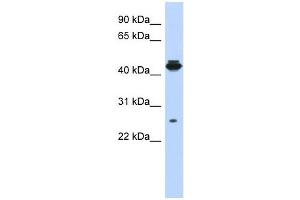 Image no. 1 for anti-PDLIM1 Interacting Kinase 1 Like (PDIK1L) (Middle Region) antibody (ABIN632750)