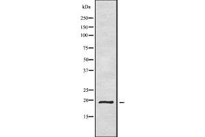 Western blot analysis of CD164L2 using HepG2 whole cell lysates