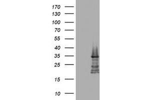 Image no. 4 for anti-ATP-Binding Cassette, Sub-Family B (MDR/TAP), Member 1 (ABCB1) (AA 995-1280) antibody (ABIN1491725)