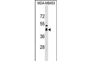 ALX1 Antibody (Center) (ABIN1538707 and ABIN2849356) western blot analysis in MDA-M cell line lysates (35 μg/lane).