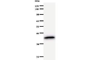 Image no. 1 for anti-CCR4-NOT Transcription Complex, Subunit 2 (CNOT2) antibody (ABIN932185)