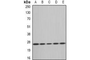 Image no. 2 for anti-Methionine Sulfoxide Reductase A (MSRA) antibody (ABIN2966814)