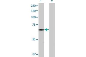 Western Blot analysis of SNCAIP expression in transfected 293T cell line by SNCAIP MaxPab polyclonal antibody.