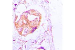 Image no. 1 for anti-Palladin, Cytoskeletal Associated Protein (PALLD) (Center) antibody (ABIN2706765)