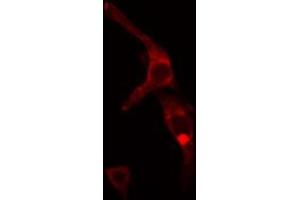 Image no. 1 for anti-Transducin (Beta)-Like 2 (TBL2) antibody (ABIN6265481)
