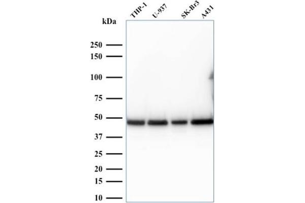 RPSA/Laminin Receptor antibody