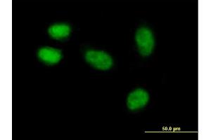 Image no. 2 for anti-Melanoma Antigen Family A, 11 (MAGEA11) (AA 1-319) antibody (ABIN517704)