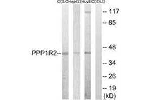 Image no. 1 for anti-Protein Phosphatase 1, Regulatory (Inhibitor) Subunit 2 (PPP1R2) (AA 10-59) antibody (ABIN1533188)