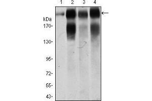 Image no. 3 for anti-Integrin beta 4 (ITGB4) (AA 1619-1822) antibody (ABIN1724805)