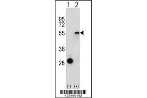 Western Blotting (WB) image for anti-Estrogen-Related Receptor alpha (ESRRA) antibody (ABIN2158744)