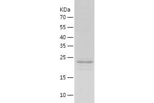 NUDT21 Protein (AA 1-227) (His tag)