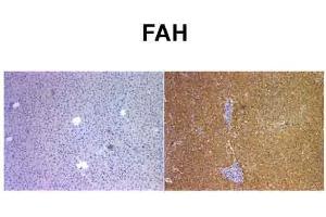 Image no. 2 for anti-Fumarylacetoacetate Hydrolase (Fumarylacetoacetase) (FAH) (C-Term) antibody (ABIN2776935)