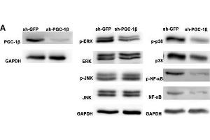Image no. 2 for anti-Peroxisome Proliferator-Activated Receptor Gamma, Coactivator 1 beta (PPARGC1B) (AA 901-1023) antibody (ABIN872354)