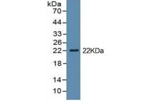 Rabbit Capture antibody from the kit in WB with Positive Control: Cell culture supernatant and 293F cell lysate which transfected with mouse IL1b gene.