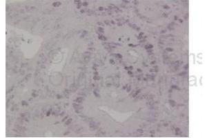 Image no. 5 for anti-MutS Homolog 6 (E. Coli) (MSH6) (N-Term) antibody (ABIN2776759)