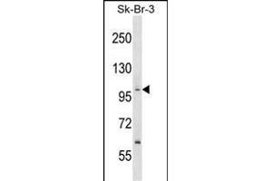 P1R13B Antibody (Center) (ABIN1538543 and ABIN2848839) western blot analysis in SK-BR-3 cell line lysates (35 μg/lane).