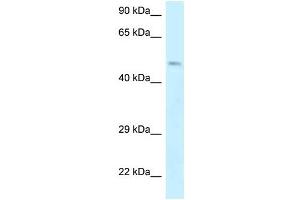 Image no. 1 for anti-erythrocyte Membrane Protein Band 4.9 (Dematin) (EPB49) (Middle Region) antibody (ABIN926778)