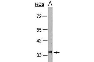 Image no. 1 for anti-Leukotriene B4 Receptor (LTB4R) (Internal Region) antibody (ABIN2857016)