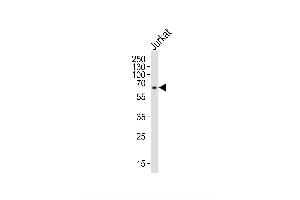 Image no. 4 for anti-Interleukin 2 Receptor, gamma (IL2RG) (AA 76-101), (N-Term) antibody (ABIN653403)
