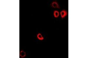 Image no. 1 for anti-6-Pyruvoyltetrahydropterin Synthase (PTS) (full length) antibody (ABIN6005316)