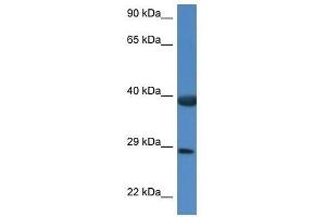 Image no. 1 for anti-HSPA Binding Protein, Cytoplasmic Cochaperone 1 (HSPBP1) (C-Term) antibody (ABIN928748)